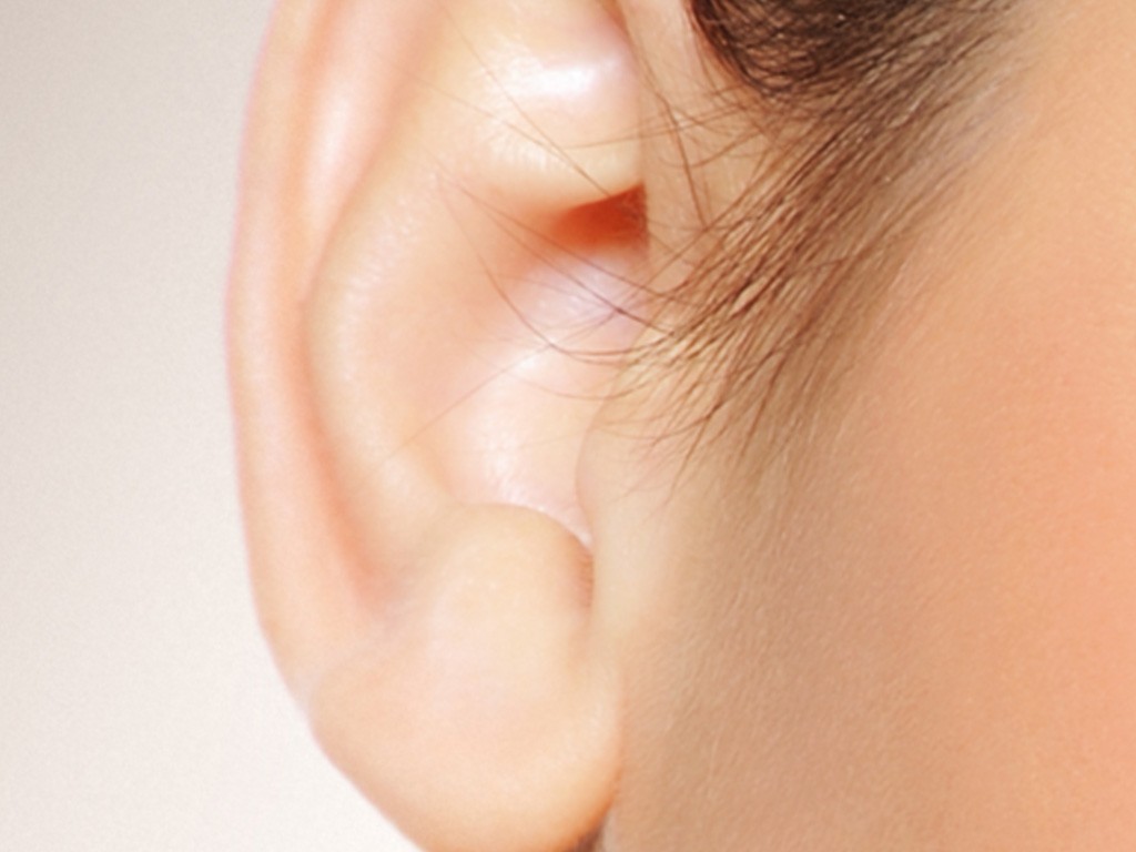 otoplasty - ear surgery Barrington, IL